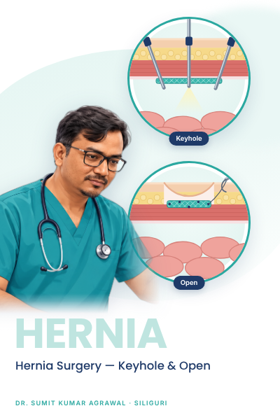 03 hernia surgery