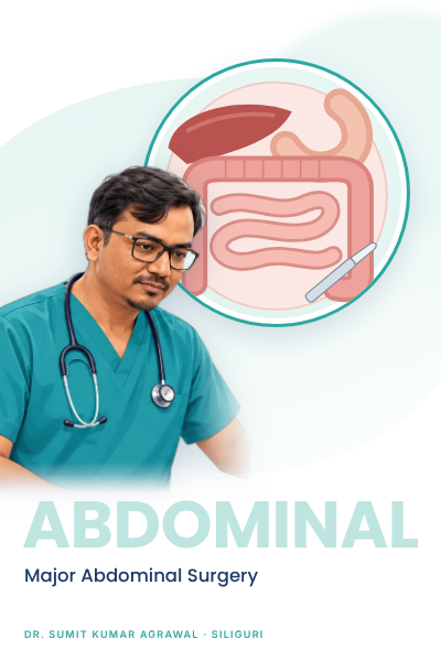 08 major abdominal surgery